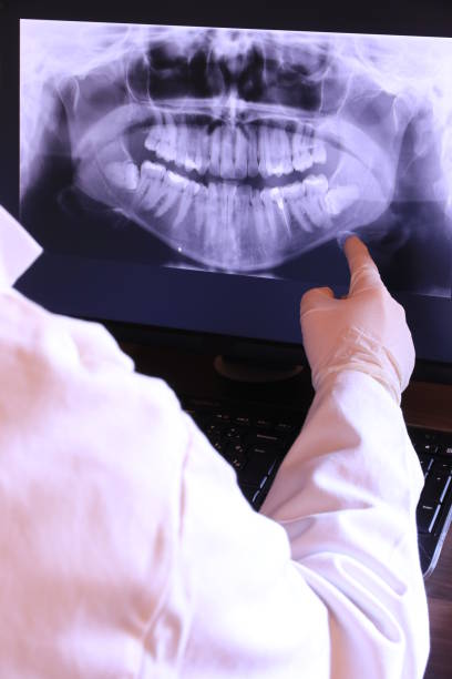 Best Emergency Dental Care for Broken or Chipped Teeth in Methuen Town, MA